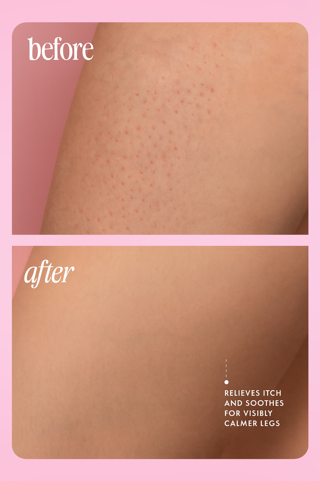 Vitabie™ Velvet Blossom After Shave Oil