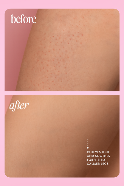 Vitabie™ Velvet Blossom After Shave Oil
